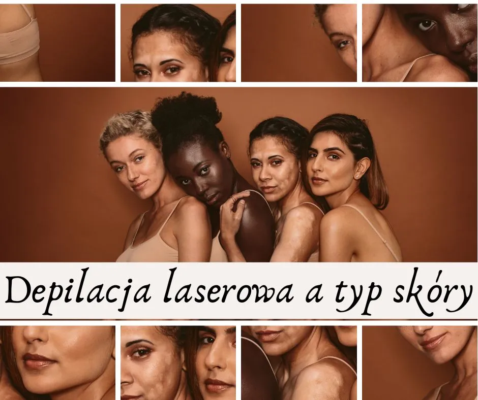 Czy przed zabiegiem depilacji laserowej można się opalać? />